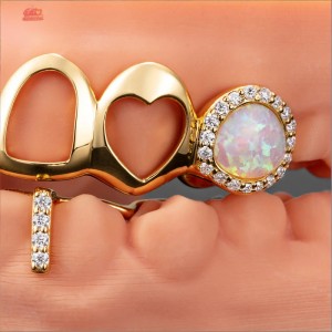 Best Custom Gold and Diamond Grillz